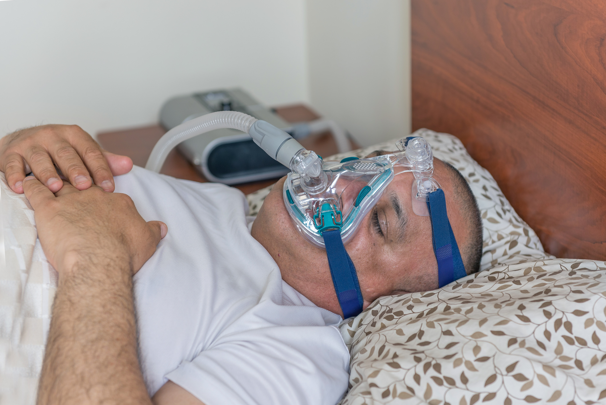 Mildly obese man suffering from sleep apnea, lying asleep on his back in bed with a CPAP treatment mask on his face. 