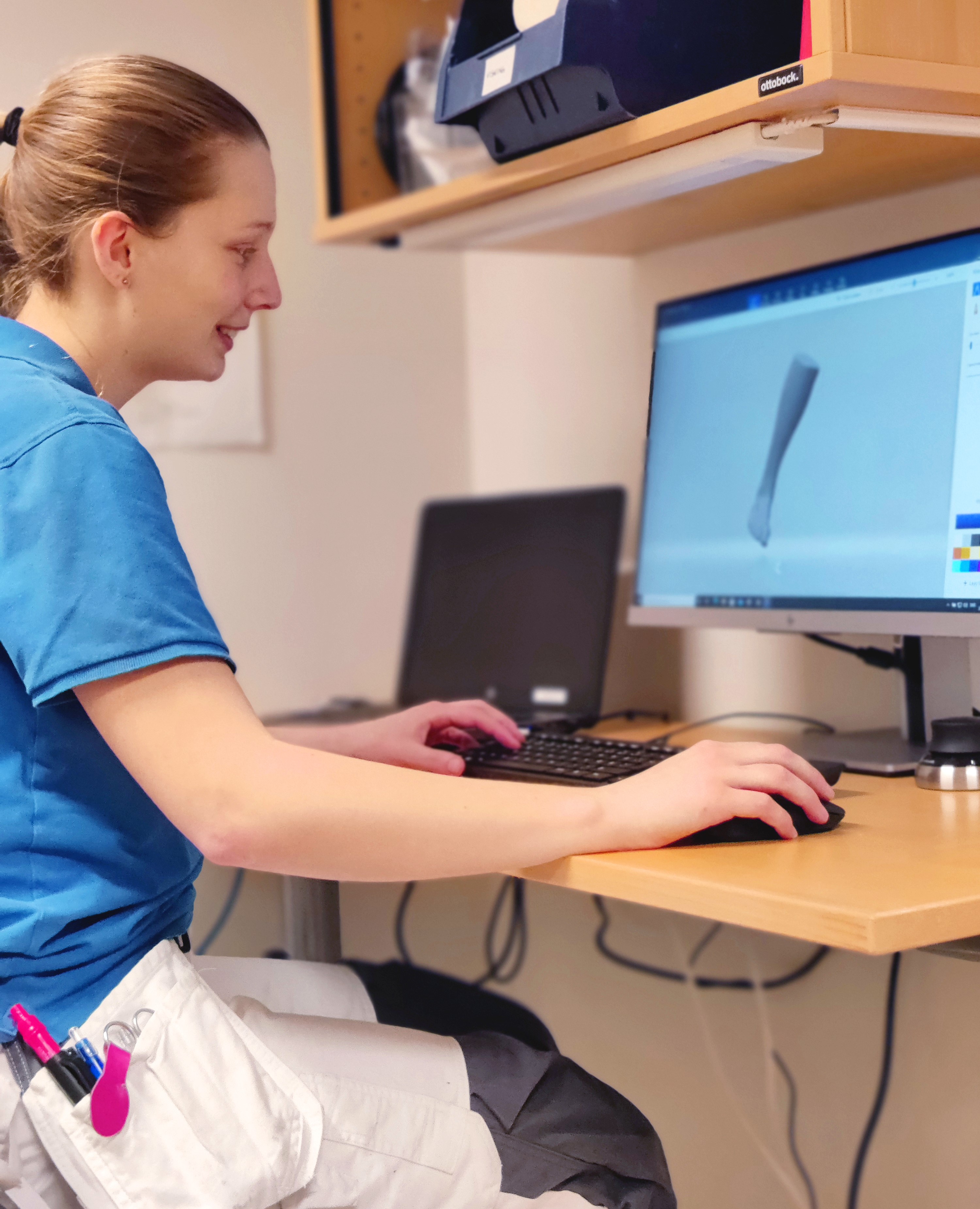 Kvinna framför dator som visar en fotprotes.